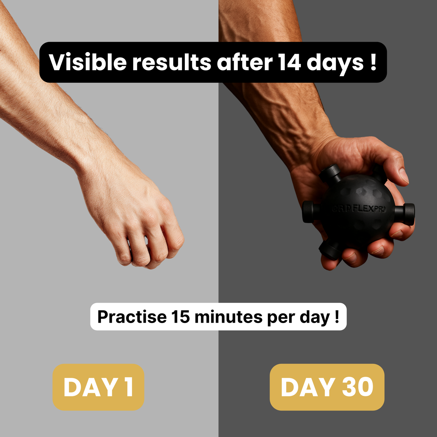 The VeinGripBall